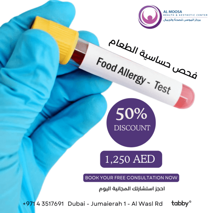 Food Allergy Test